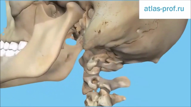 Смещение атланта у детей фото