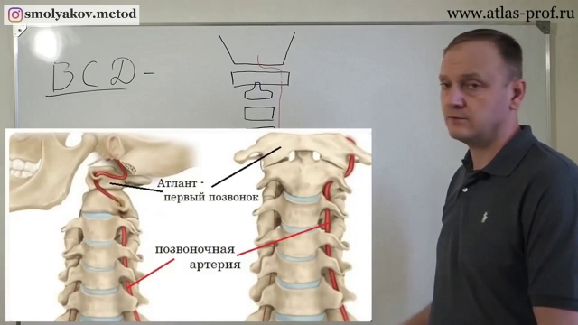 Смещение атланта у детей фото